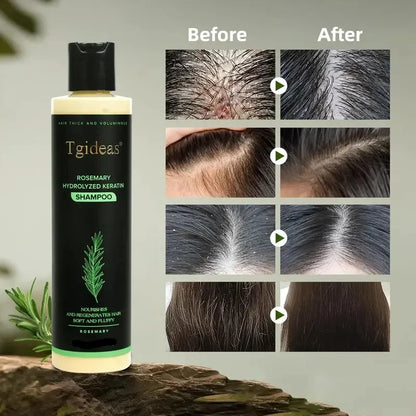 🌿🌿Rosemary Shampoo | Hair Growth & Anti-Dandruff Scalp Treatment